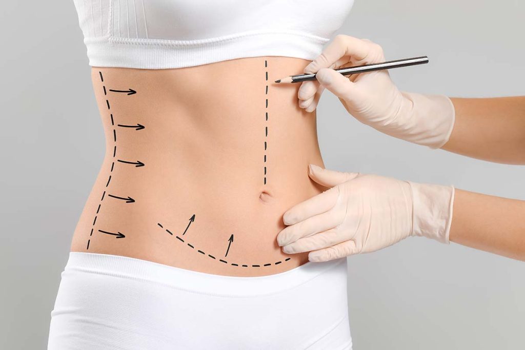 Tummy Tuck Band WOMEN Abdominal Cosmetic Surgery MADE IN USA
